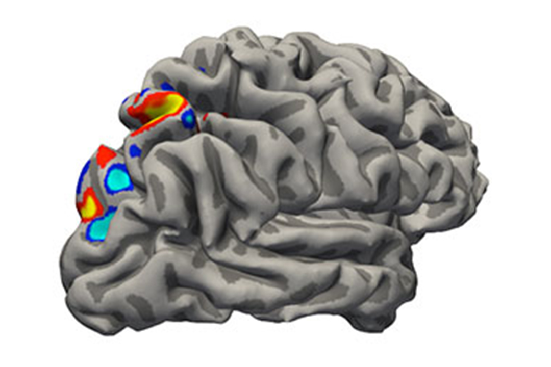 Recovering After A Stroke Unlocking The Brain s Secret Strategy 